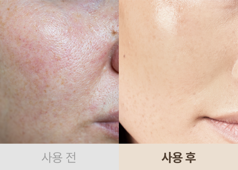 세라마이드 부스터